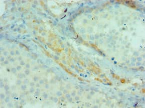BIRC2 / cIAP1 Antibody (aa1-300)