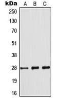 BCL2 / Bcl-2 Antibody (phospho-Ser70)