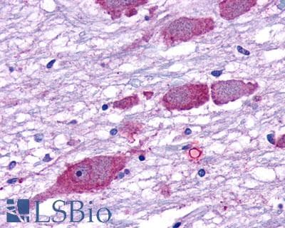 PathPlus™ GPR162 Antibody (Extracellular Domain)