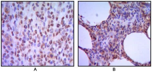 MUM1 Antibody (clone 4G10)
