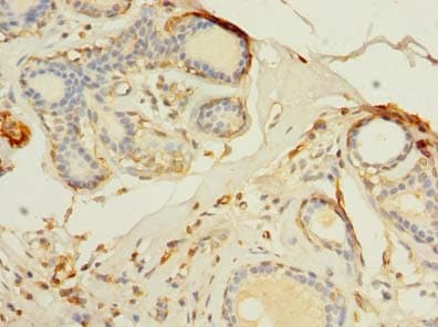 Polyclonal Rabbit anti-Human TMEM176B / LR8 Antibody (IHC, WB)