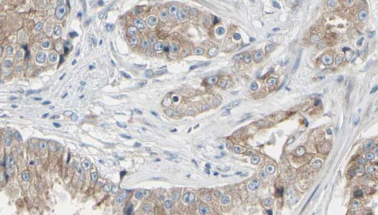 Polyclonal Rabbit anti-Human GAL4 / Galectin 4 Antibody (IHC, IF, WB)