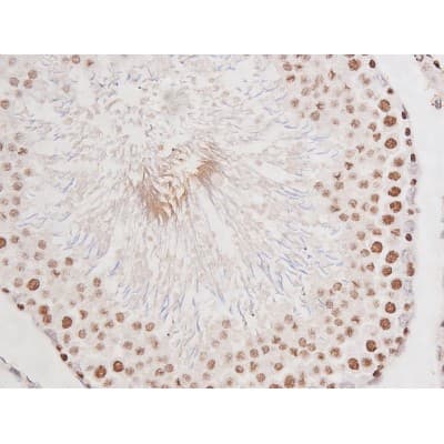 Polyclonal Rabbit anti-Human MAPT / Tau Antibody (phospho-Ser235, IHC, WB)