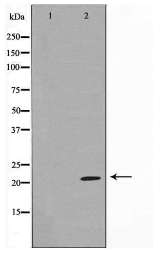 Polyclonal Rabbit anti-Human TPD52L2 / HD54 Antibody (WB)