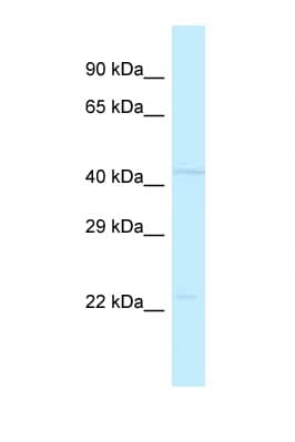 Polyclonal Rabbit anti-Human POLDIP3 / p46 Antibody (C-Terminus, WB)