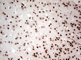 Monoclonal Mouse anti-Human NUMB Antibody (clone OTI2F1, aa1-365, IHC, WB)