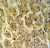 NDUFS2 Antibody (aa286-315)