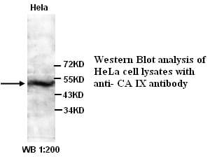 Polyclonal Rabbit anti-Human CA9 / Carbonic Anhydrase IX Antibody (C-Terminus, IHC, WB)