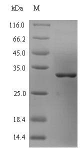 Chlamydia pneumoniae omcB Protein (Recombinant 6His-SUMO, N-terminus)