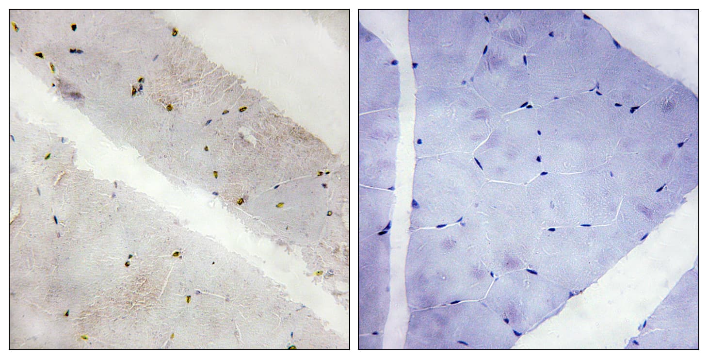 LATS2 Antibody (aa541-590)