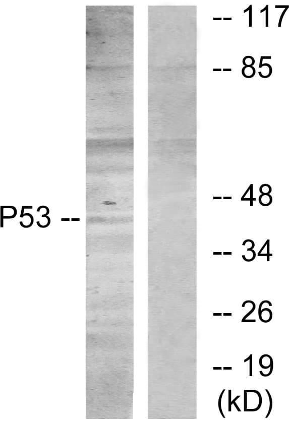 TP53 / p53 Antibody (aa281-330)