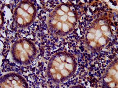 Polyclonal Rabbit anti-Human CD99L2 Antibody (IHC, IF)