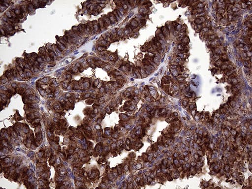 CLTA / LCA Antibody (clone OTI2D12, Carrier-free)