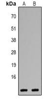 CXCL1 / GRO Alpha Antibody (C-Terminus)