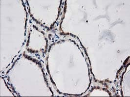 Monoclonal Mouse anti-Human ARFGAP1 Antibody (clone OTI1F6, IHC, IF, WB)