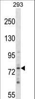 ZNF81 Antibody (aa169-197)