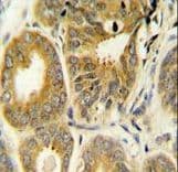 ARL8A Antibody (aa116-142)
