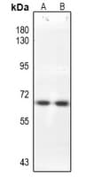 Polyclonal Rabbit anti-Human CDC25B Antibody (IHC, IF, WB)