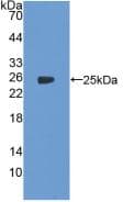 PTGS2 / COX2 / COX-2 Antibody (aa418-589)