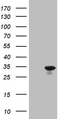 SNX10 Antibody (clone OTI3D10)