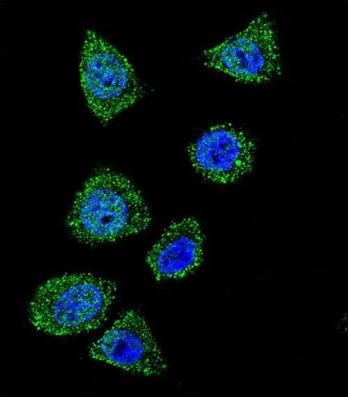 Polyclonal Rabbit anti-Human TOP1 / Topoisomerase I Antibody (aa2-31, IF, WB)