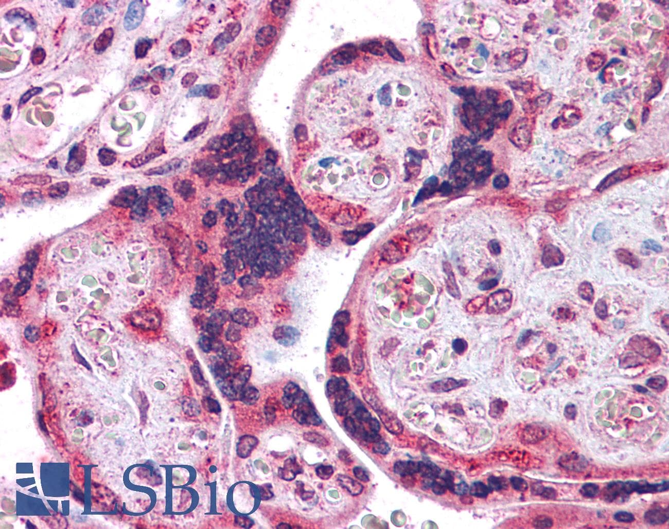 IHC-plus™ Polyclonal Rabbit anti-Human C4.4A / LYPD3 Antibody (N-Terminus, IHC)