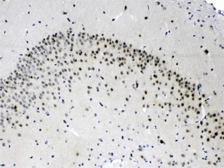 PSMA3 Antibody