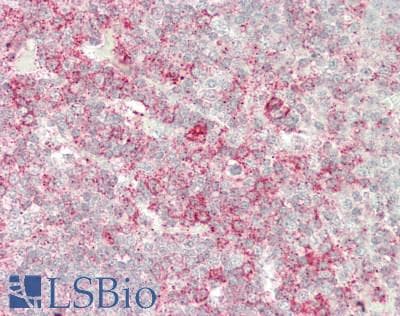 IHC-plus™ Polyclonal Rabbit anti-Human HLA-DQA1 Antibody (IHC, WB)