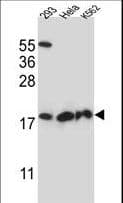 Polyclonal Rabbit anti-Human DHFRL1 Antibody (aa45-74, IHC, WB)