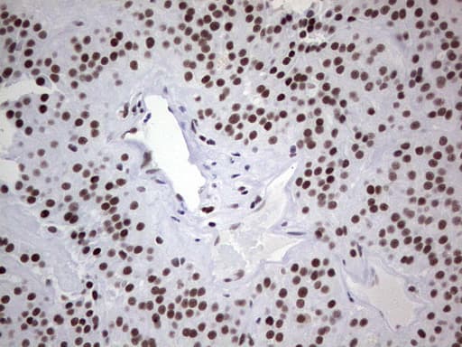 Monoclonal Mouse anti-Human HDAC9 Antibody (clone OTI7G2, aa181-460, IHC, WB)