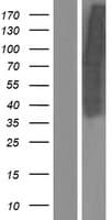 Human IRS1 Protein (Over-Expression Lysate Myc-DDK (Flag))
