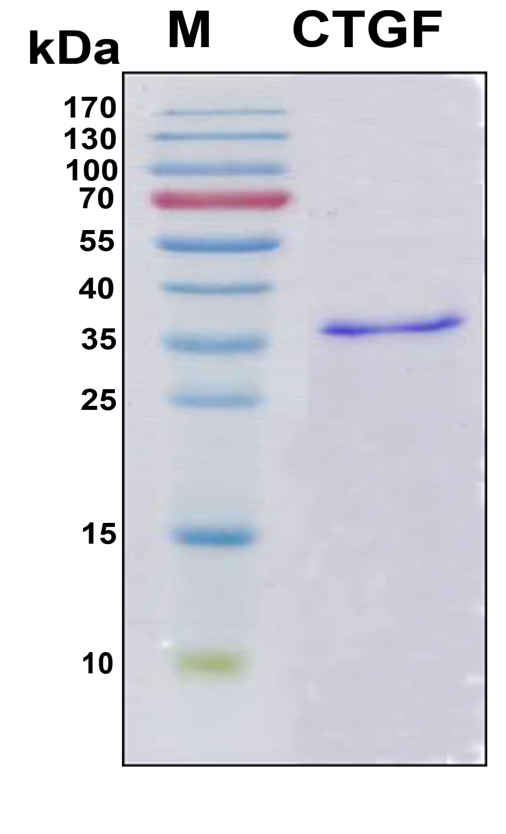 Human CTGF Protein (Recombinant 6His, N-terminus)
