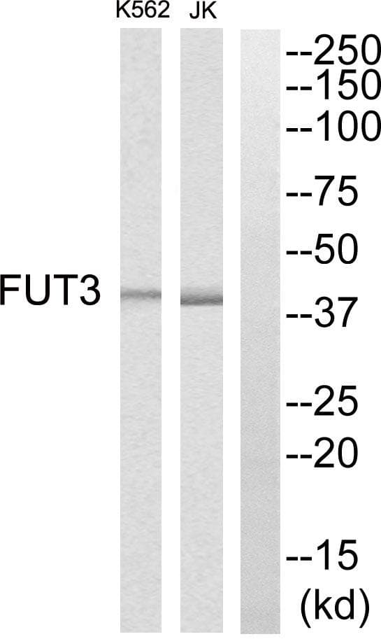 Polyclonal Rabbit anti-Human FUT3 Antibody (IHC, WB)