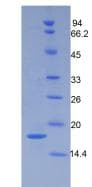 Mouse POSTN / Periostin Protein (Recombinant His)