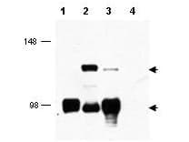 IHC-plus™ CRTC1 / MECT1 / TORC1 Antibody