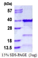 Human GTF2E2 Protein (Recombinant His)