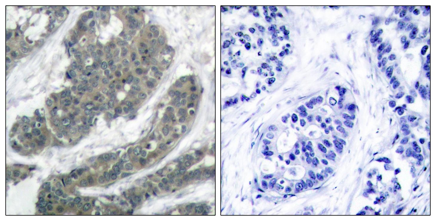 DOK1 Antibody (p398)