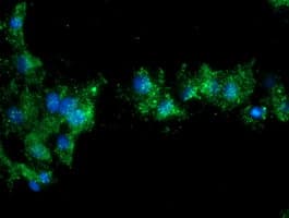NQO2 Antibody (clone OTI5F6)