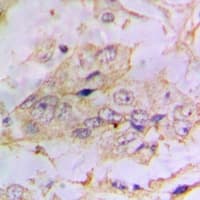Polyclonal Rabbit anti-Human PTEN Antibody (IHC, WB)