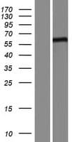 FBXL16 Protein (Over-Expression Lysate Myc-DDK (Flag))
