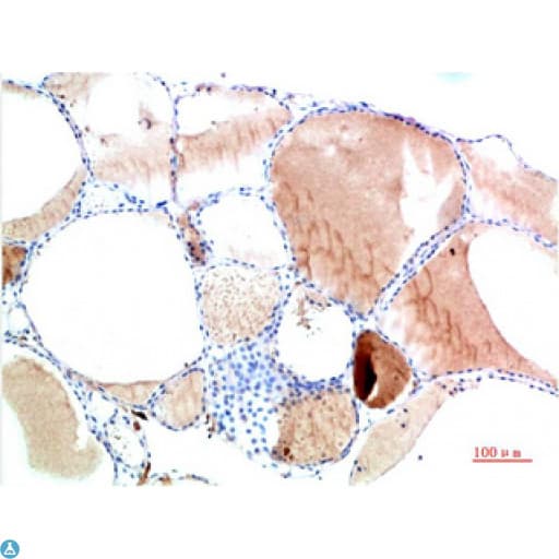 TTR / Transthyretin Antibody