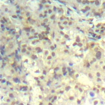 CFL1 / Cofilin Antibody (phospho-Tyr139)