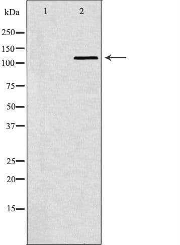Polyclonal Rabbit anti-Human SMARCA5 / SNF2H Antibody (IHC, WB)