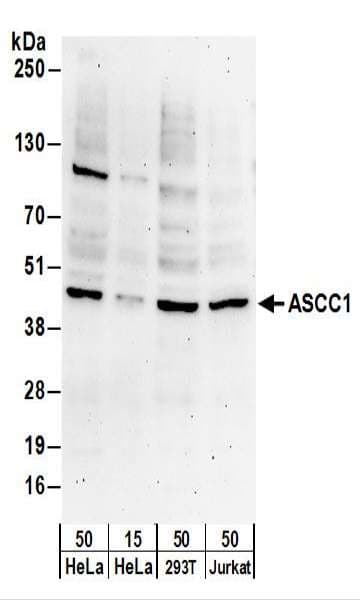 ASCC1 Antibody (aa1-50)