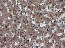 Mannose Phosphate Isomerase Antibody (clone OTI4G7)