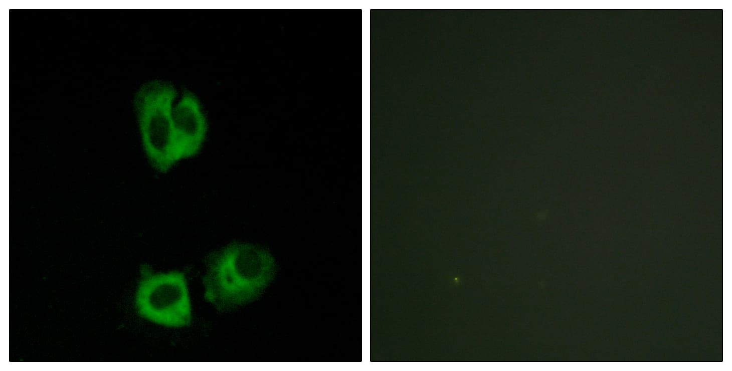 p56lck / LCK Antibody (phospho-Tyr393)