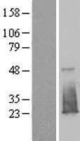 EVA1B Protein (Over-Expression Lysate Myc-DDK (Flag))
