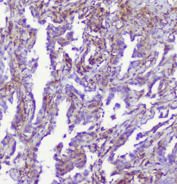 RP2 Antibody