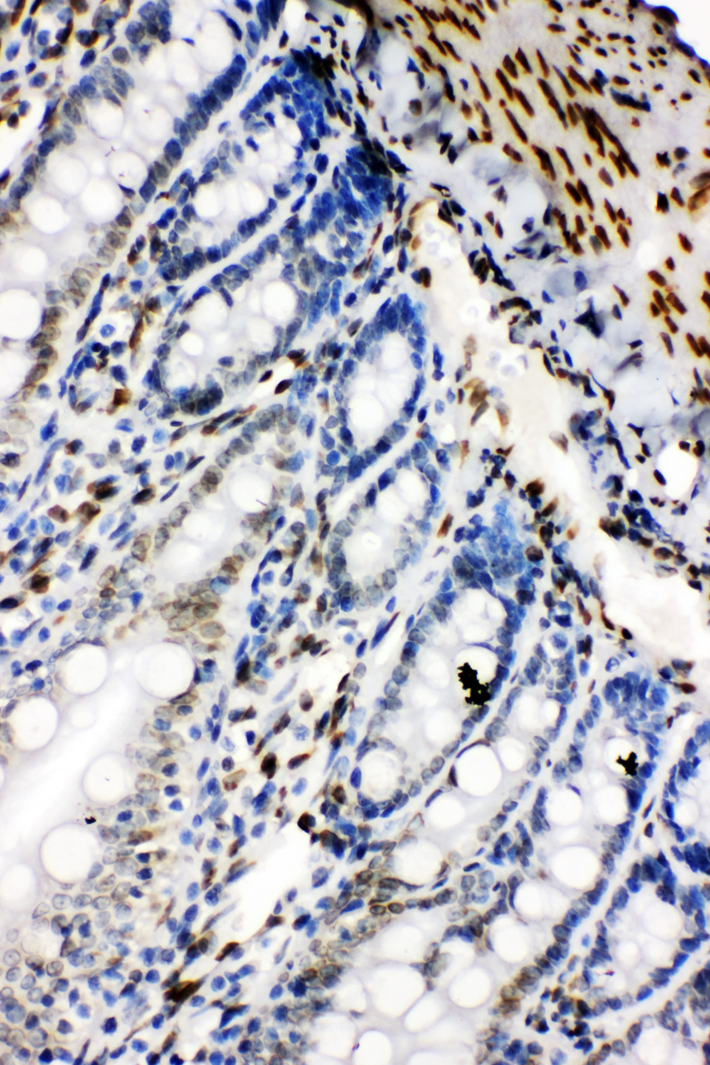 LMNB2 / Lamin B2 Antibody (aa580-597)