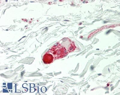 IHC-plus™ GRIN1 / NMDAR1 Antibody